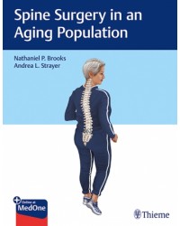 Spine Surgery in an Aging Population